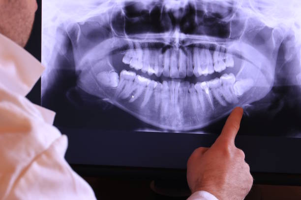 Best Mobile Emergency Dentist in Russells Point, OH