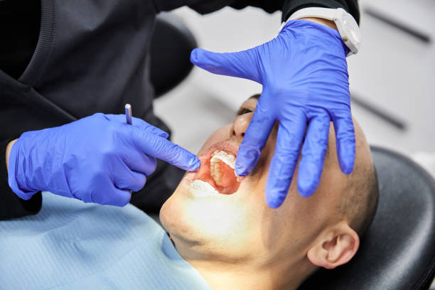 Best Emergency Dentist for Lost Fillings or Crowns in Russells Point, OH